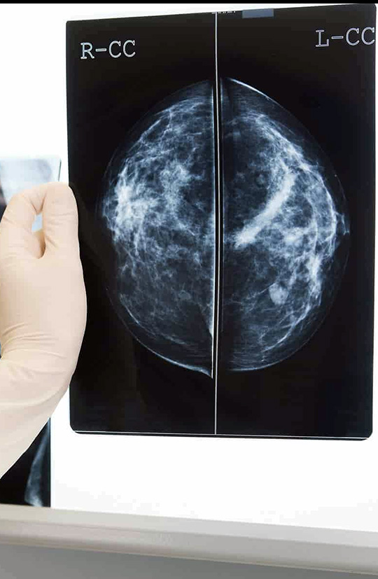 inner-banner-Mammography