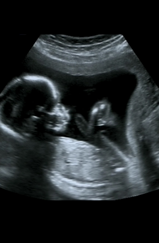 inner-banner-Obstetric-Ultrasound