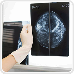 services-Mammography