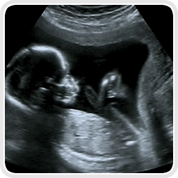 services-Obstetric-Ultrasound